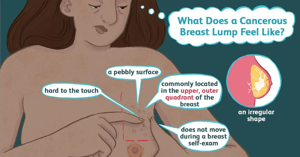 What Does Breast Cancer Look Like