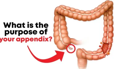 Your Appendix Do